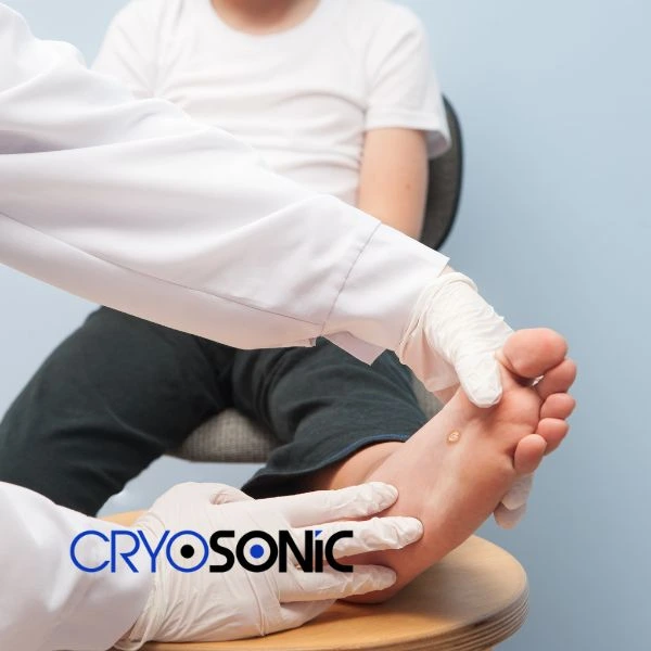 Are you looking for fast effective wart removal Contact us today Southampton