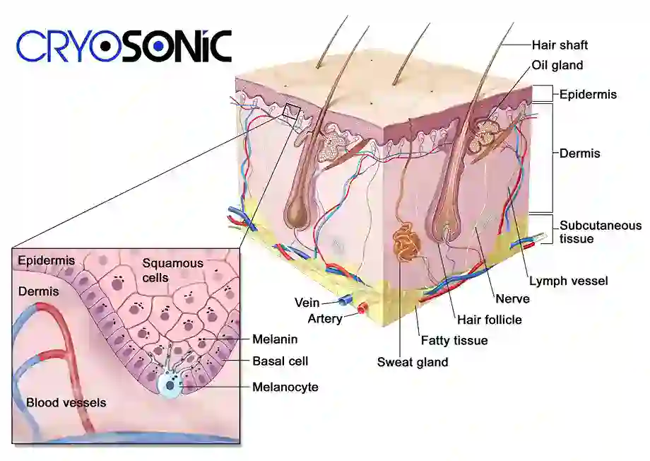 How Cryotherapy Stimulates Melanocyte Activity Southampton